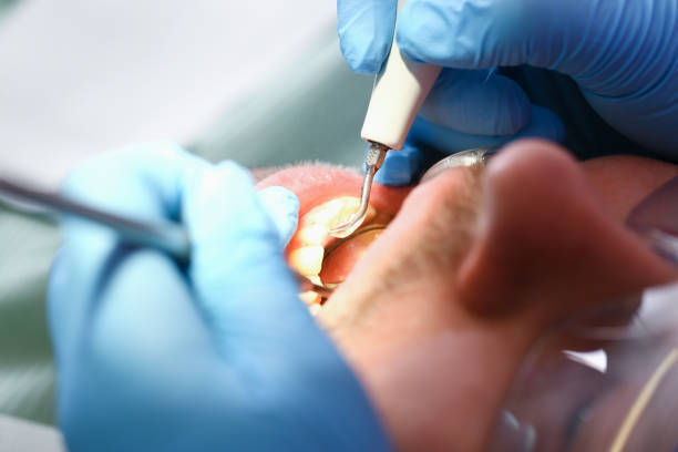 Best Emergency Treatment for Oral Infections in Helena West Helena, AR